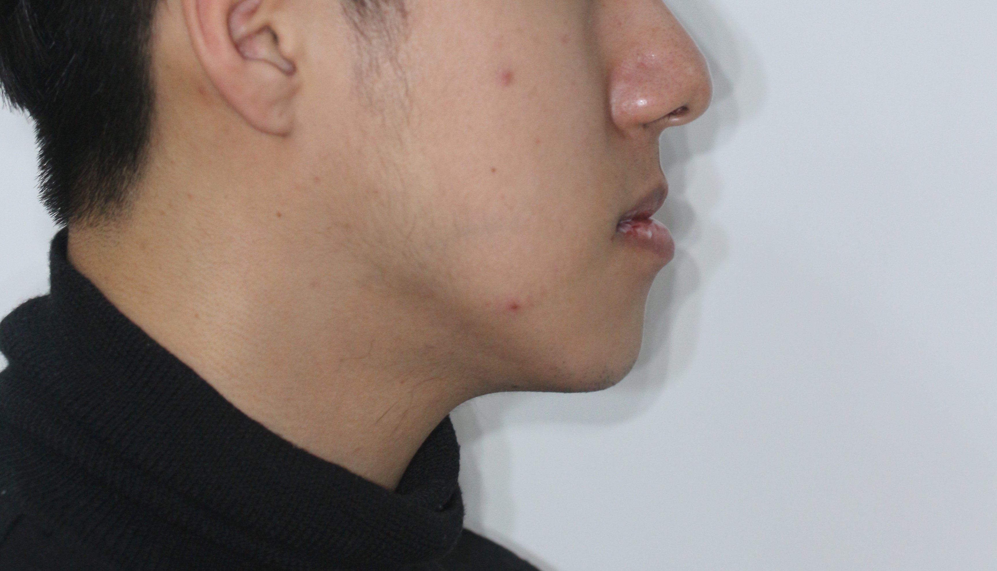 Before