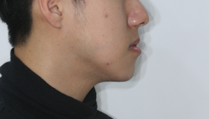 Before