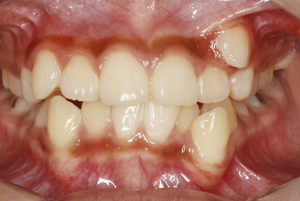 Before