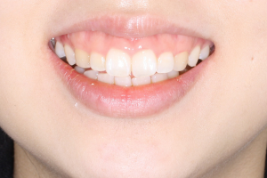 Before