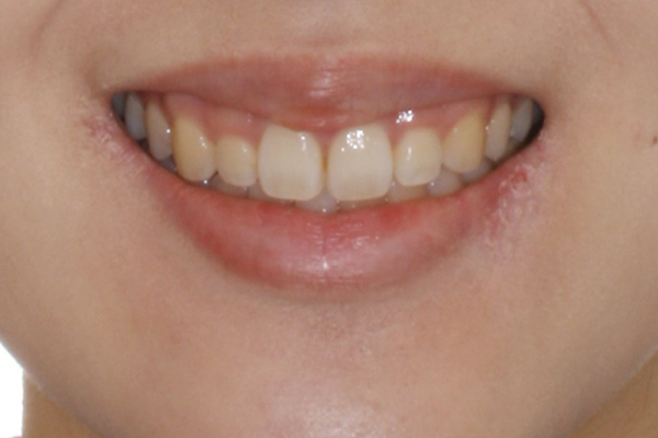 After