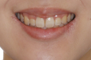 After