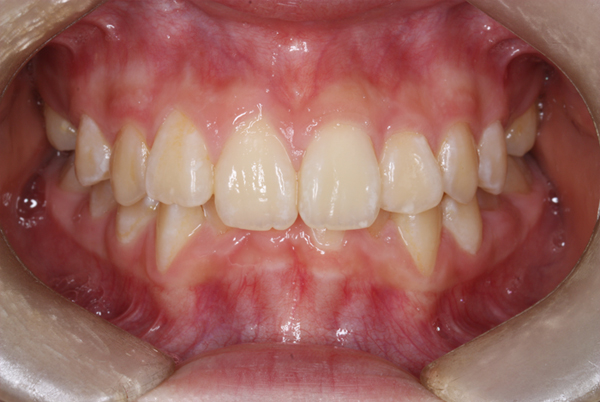 Before