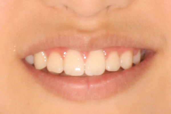 After