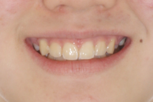 After