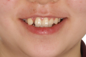 Before