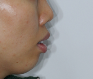 Before