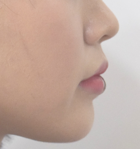 After